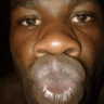 kiss