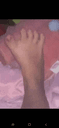 Foot