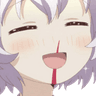nosebleed