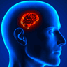 smallbrain