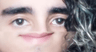 feps