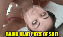 brain dead