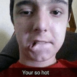 ur so hot
