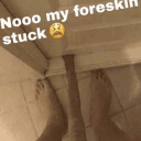 foreskin