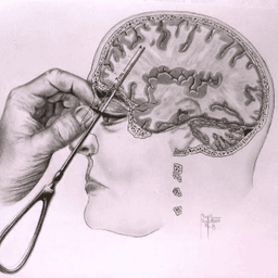 Lobotomy sound Lobotomy sound